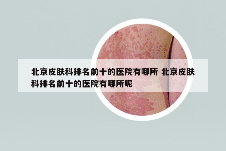 北京皮膚科排名前十的醫(yī)院有哪所 北京皮膚科排名前十的醫(yī)院有哪所呢