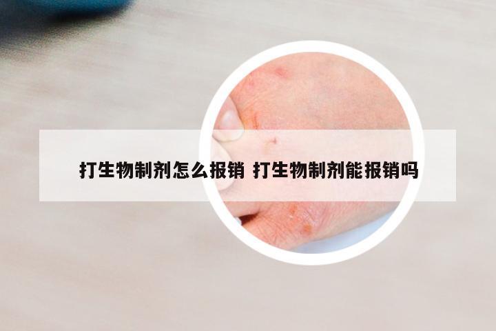 打生物制劑怎么報銷 打生物制劑能報銷嗎
