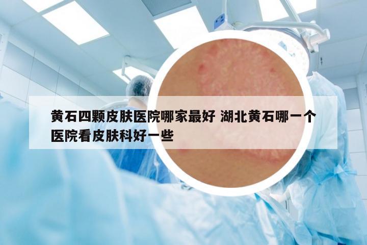 黃石四顆皮膚醫(yī)院哪家最好 湖北黃石哪一個醫(yī)院看皮膚科好一些