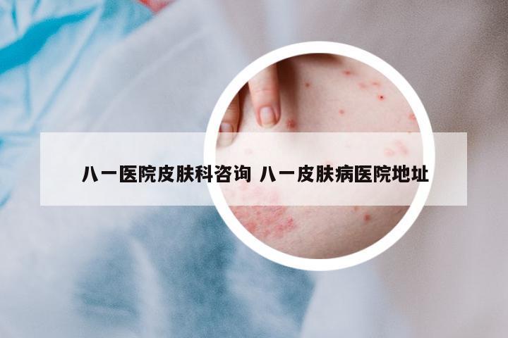 八一醫(yī)院皮膚科咨詢 八一皮膚病醫(yī)院地址
