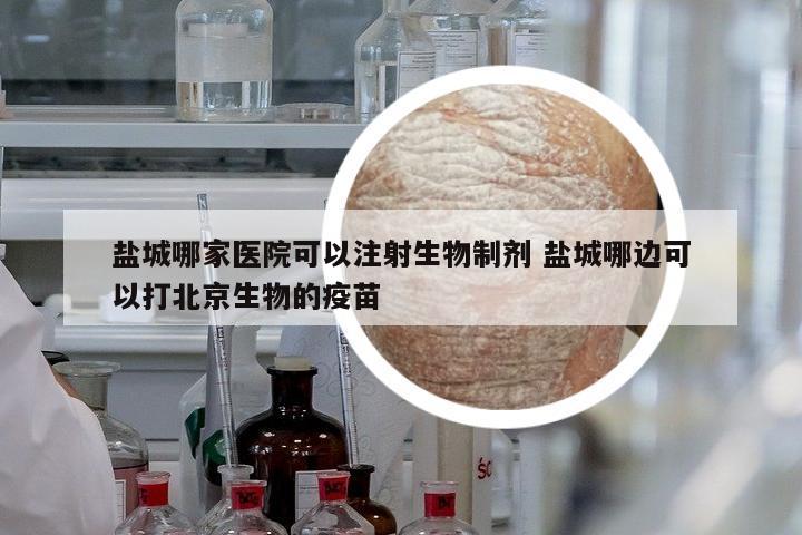 鹽城哪家醫(yī)院可以注射生物制劑 鹽城哪邊可以打北京生物的疫苗