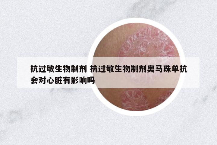 抗過敏生物制劑 抗過敏生物制劑奧馬珠單抗會(huì)對(duì)心臟有影響嗎