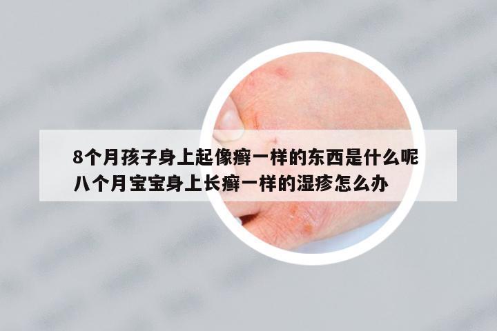 8個月孩子身上起像癬一樣的東西是什么呢 八個月寶寶身上長癬一樣的濕疹怎么辦
