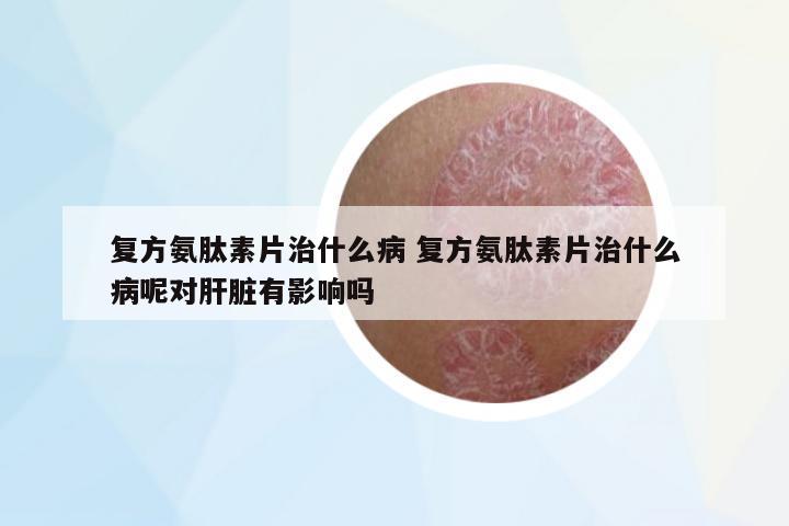 復方氨肽素片治什么病 復方氨肽素片治什么病呢對肝臟有影響嗎