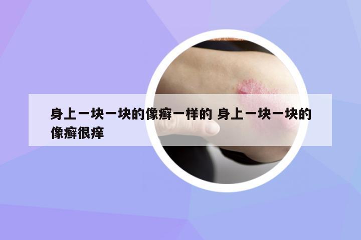 身上一塊一塊的像癬一樣的 身上一塊一塊的像癬很癢