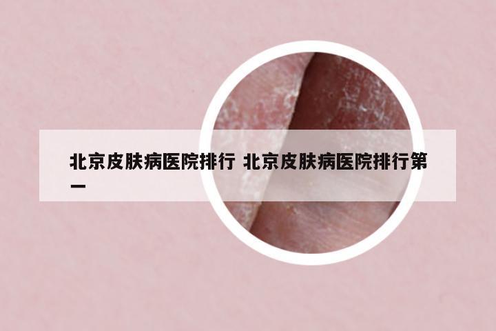 北京皮膚病醫(yī)院排行 北京皮膚病醫(yī)院排行第一