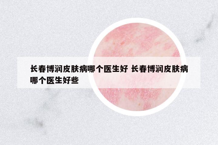 長春博潤皮膚病哪個(gè)醫(yī)生好 長春博潤皮膚病哪個(gè)醫(yī)生好些