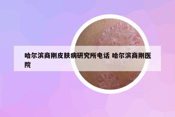 哈爾濱商剛皮膚病研究所電話 哈爾濱商剛醫(yī)院