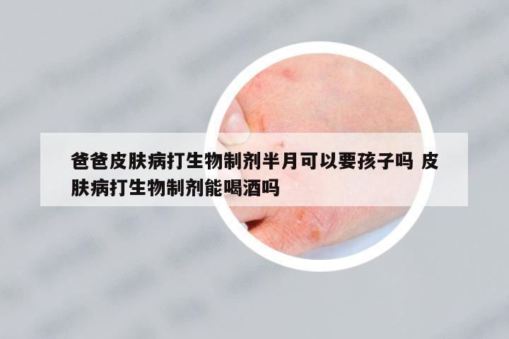 爸爸皮膚病打生物制劑半月可以要孩子嗎 皮膚病打生物制劑能喝酒嗎