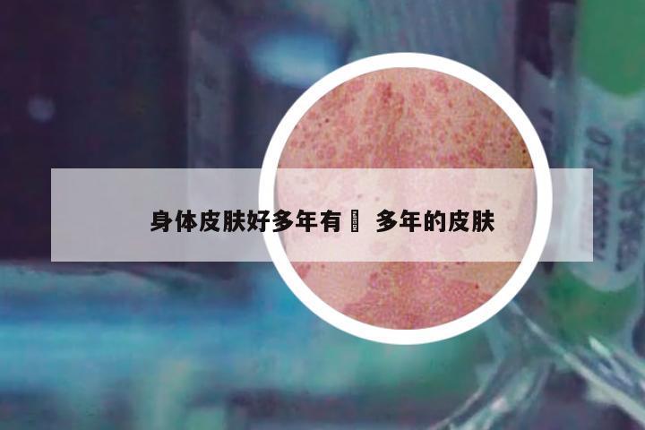 身體皮膚好多年有廯 多年的皮膚