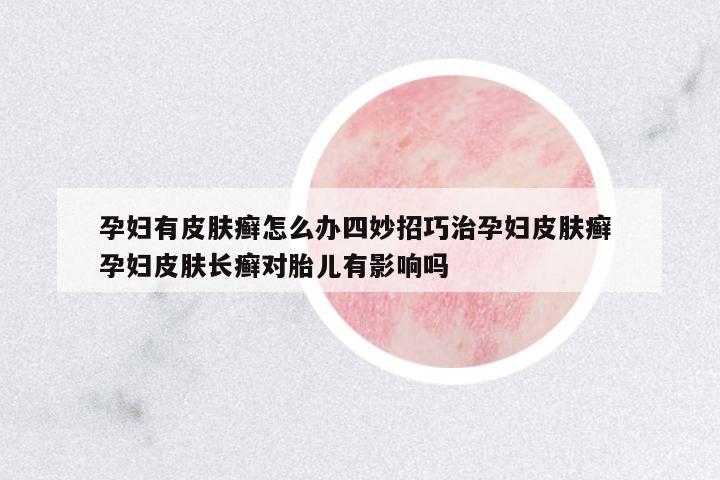 孕婦有皮膚癬怎么辦四妙招巧治孕婦皮膚癬 孕婦皮膚長(zhǎng)癬對(duì)胎兒有影響嗎