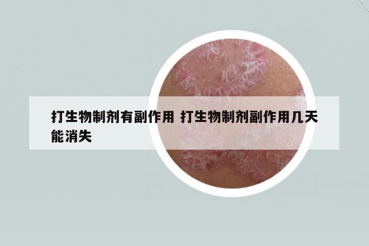 打生物制劑有副作用 打生物制劑副作用幾天能消失