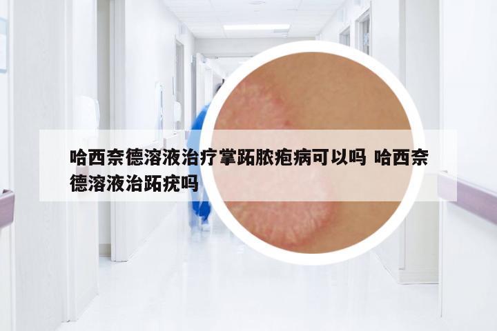 哈西奈德溶液治療掌跖膿皰病可以嗎 哈西奈德溶液治跖疣嗎