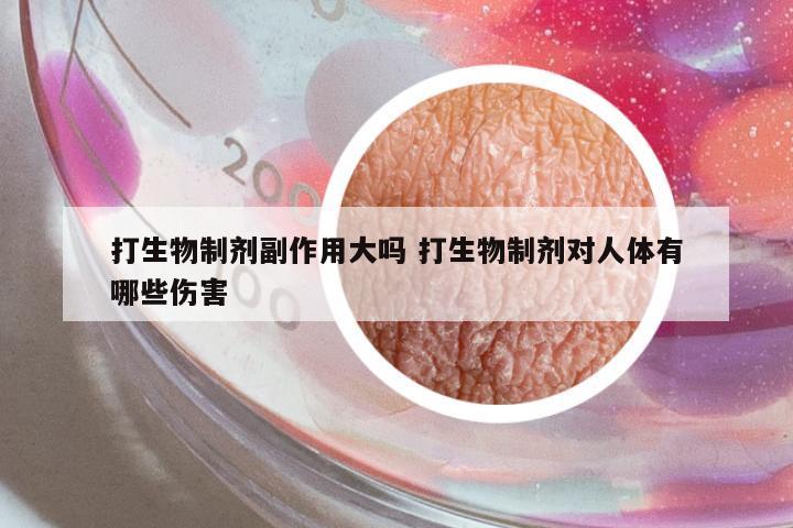 打生物制劑副作用大嗎 打生物制劑對人體有哪些傷害