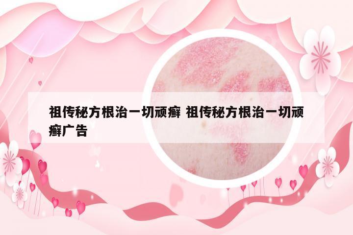 祖?zhèn)髅胤礁我磺蓄B癬 祖?zhèn)髅胤礁我磺蓄B癬廣告