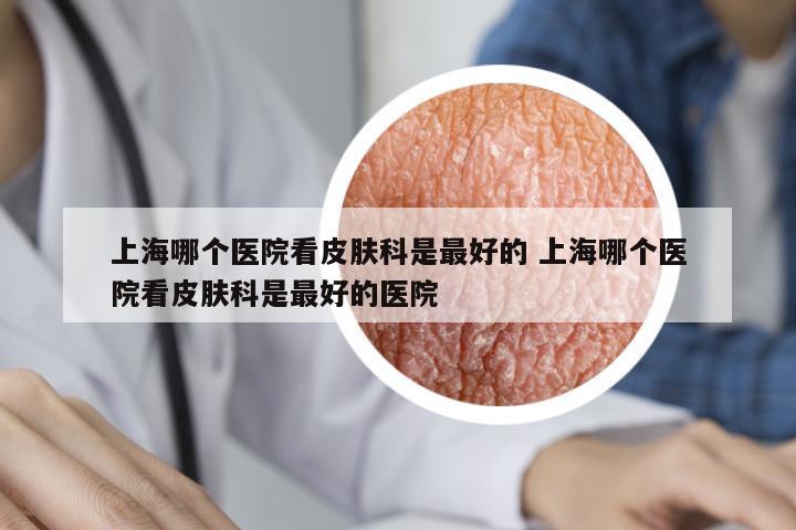上海哪個(gè)醫(yī)院看皮膚科是最好的 上海哪個(gè)醫(yī)院看皮膚科是最好的醫(yī)院