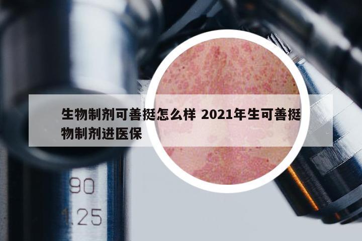 生物制劑可善挺怎么樣 2021年生可善挺物制劑進(jìn)醫(yī)保