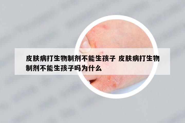 皮膚病打生物制劑不能生孩子 皮膚病打生物制劑不能生孩子嗎為什么