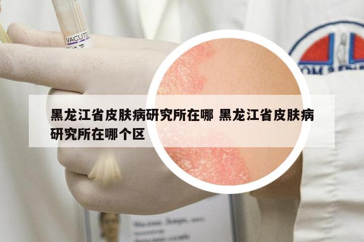 黑龍江省皮膚病研究所在哪 黑龍江省皮膚病研究所在哪個(gè)區(qū)