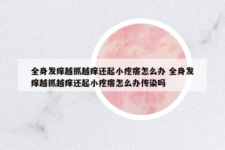 全身發(fā)癢越抓越癢還起小疙瘩怎么辦 全身發(fā)癢越抓越癢還起小疙瘩怎么辦傳染嗎
