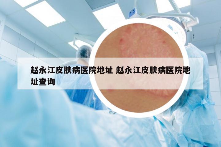 趙永江皮膚病醫(yī)院地址 趙永江皮膚病醫(yī)院地址查詢