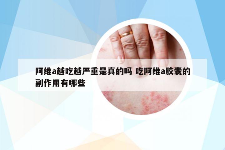 阿維a越吃越嚴(yán)重是真的嗎 吃阿維a膠囊的副作用有哪些