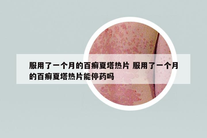 服用了一個(gè)月的百癬夏塔熱片 服用了一個(gè)月的百癬夏塔熱片能停藥嗎