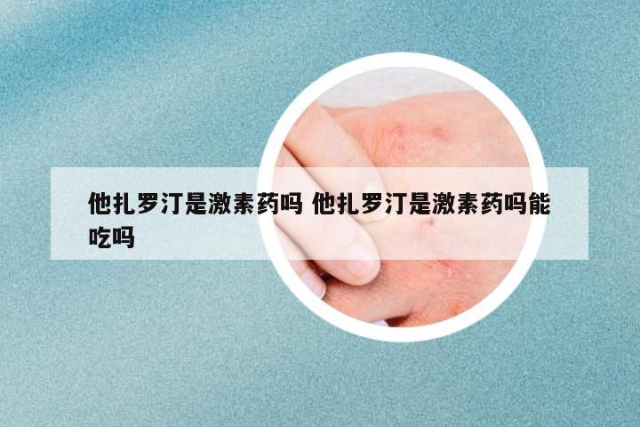 他扎羅汀是激素藥嗎 他扎羅汀是激素藥嗎能吃嗎