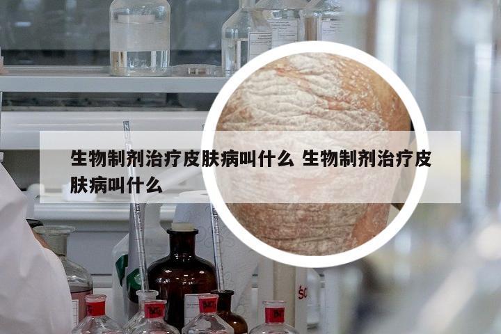 生物制劑治療皮膚病叫什么 生物制劑治療皮膚病叫什么