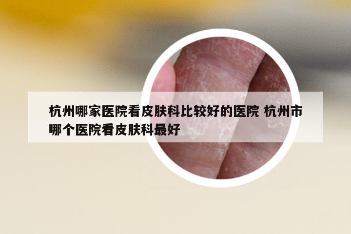 杭州哪家醫(yī)院看皮膚科比較好的醫(yī)院 杭州市哪個醫(yī)院看皮膚科最好