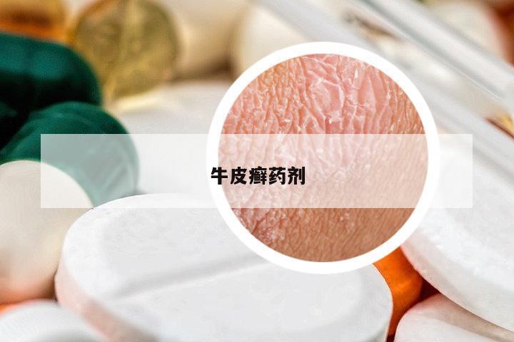 牛皮癬藥劑