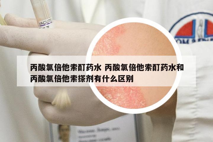 丙酸氯倍他索酊藥水 丙酸氯倍他索酊藥水和丙酸氯倍他索搽劑有什么區(qū)別