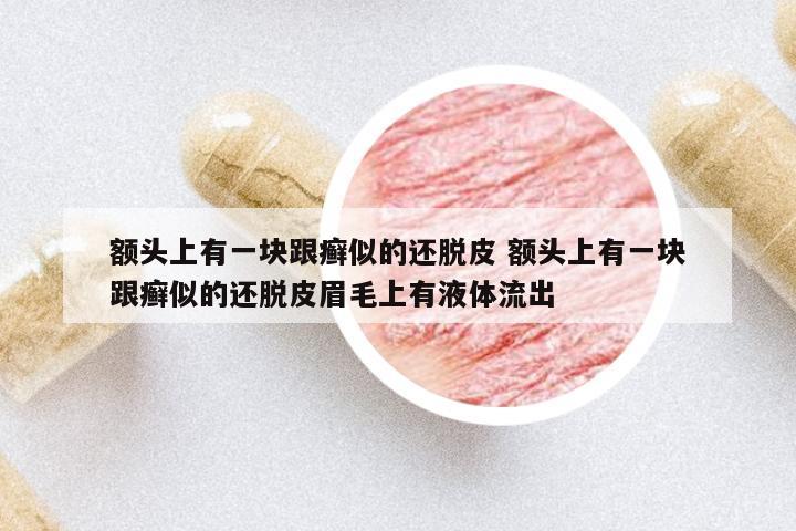 額頭上有一塊跟癬似的還脫皮 額頭上有一塊跟癬似的還脫皮眉毛上有液體流出