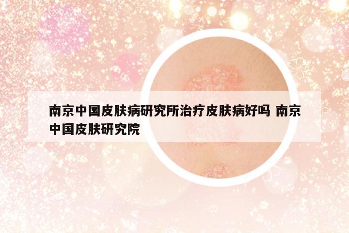 南京中國(guó)皮膚病研究所治療皮膚病好嗎 南京中國(guó)皮膚研究院