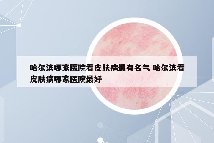 哈爾濱哪家醫(yī)院看皮膚病最有名氣 哈爾濱看皮膚病哪家醫(yī)院最好