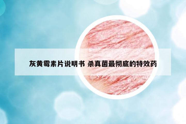 灰黃霉素片說明書 殺真菌最徹底的特效藥