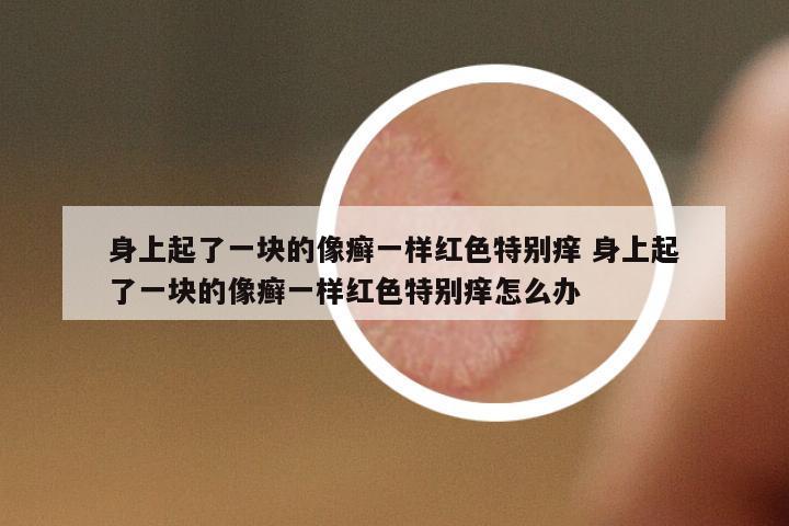 身上起了一塊的像癬一樣紅色特別癢 身上起了一塊的像癬一樣紅色特別癢怎么辦