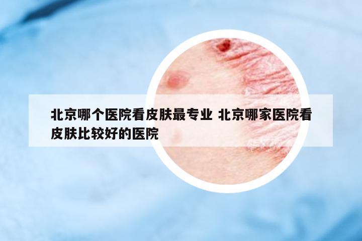 北京哪個(gè)醫(yī)院看皮膚最專業(yè) 北京哪家醫(yī)院看皮膚比較好的醫(yī)院
