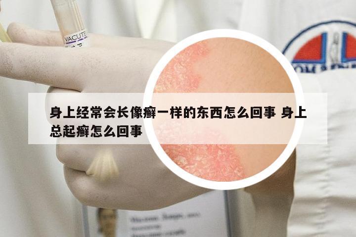 身上經(jīng)常會長像癬一樣的東西怎么回事 身上總起癬怎么回事