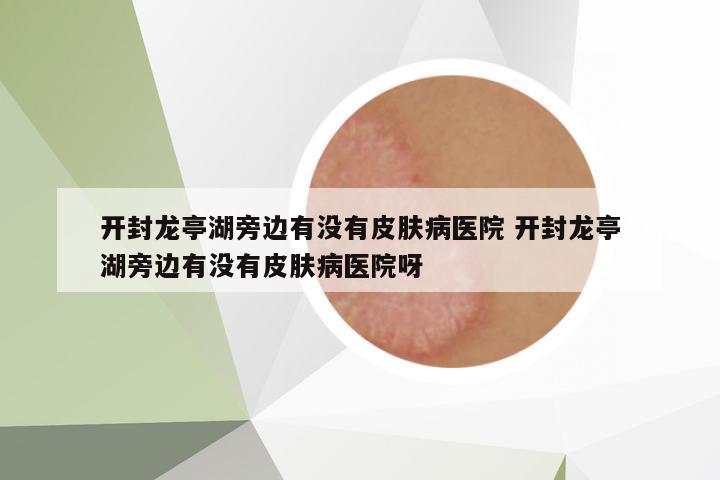 開封龍亭湖旁邊有沒有皮膚病醫(yī)院 開封龍亭湖旁邊有沒有皮膚病醫(yī)院呀