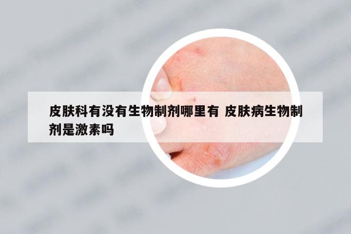 皮膚科有沒有生物制劑哪里有 皮膚病生物制劑是激素嗎