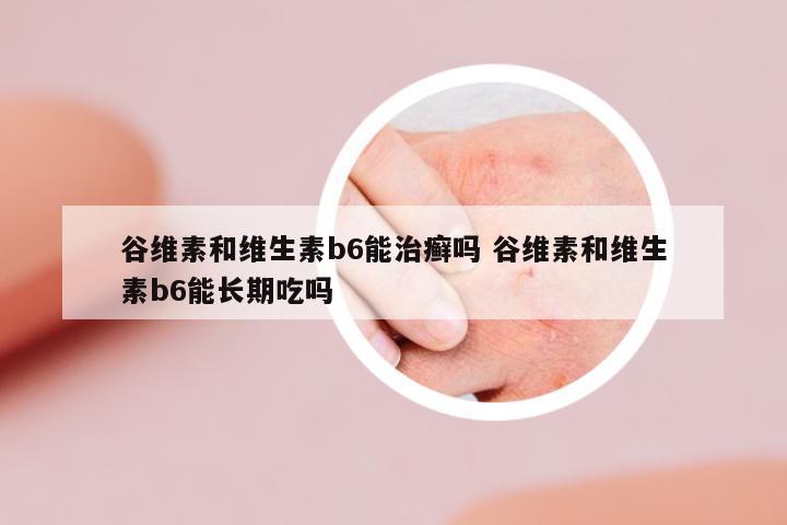 谷維素和維生素b6能治癬嗎 谷維素和維生素b6能長(zhǎng)期吃嗎