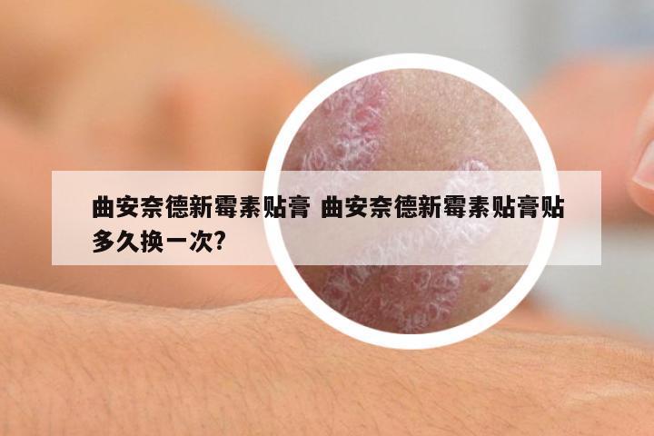 曲安奈德新霉素貼膏 曲安奈德新霉素貼膏貼多久換一次?
