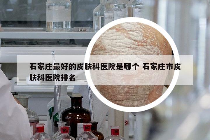 石家莊最好的皮膚科醫(yī)院是哪個(gè) 石家莊市皮膚科醫(yī)院排名