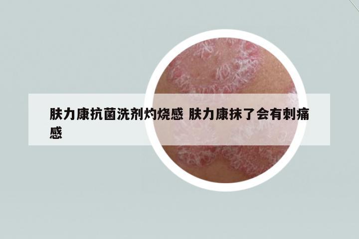 膚力康抗菌洗劑灼燒感 膚力康抹了會有刺痛感