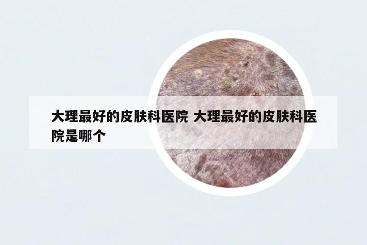 大理最好的皮膚科醫(yī)院 大理最好的皮膚科醫(yī)院是哪個(gè)