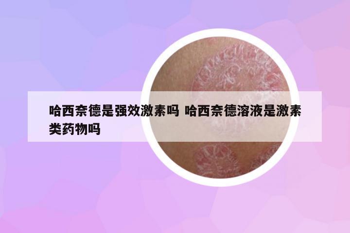 哈西奈德是強(qiáng)效激素嗎 哈西奈德溶液是激素類藥物嗎