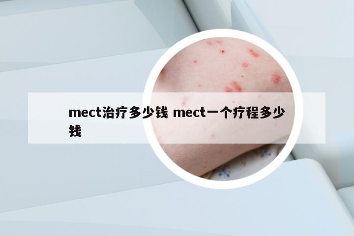 mect治療多少錢 mect一個療程多少錢