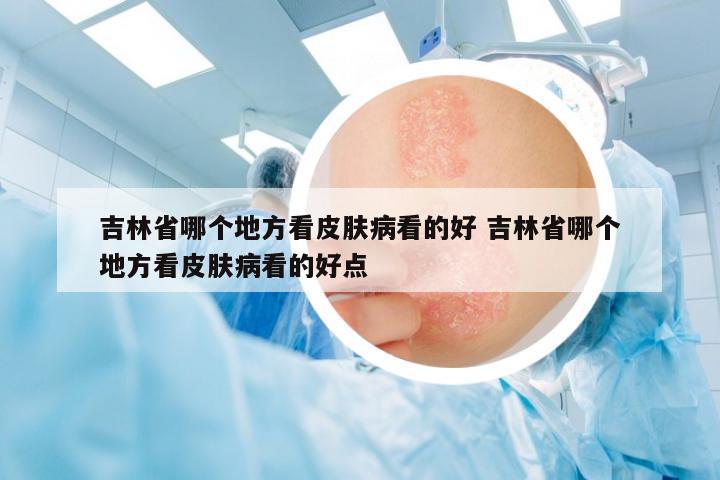 吉林省哪個地方看皮膚病看的好 吉林省哪個地方看皮膚病看的好點(diǎn)