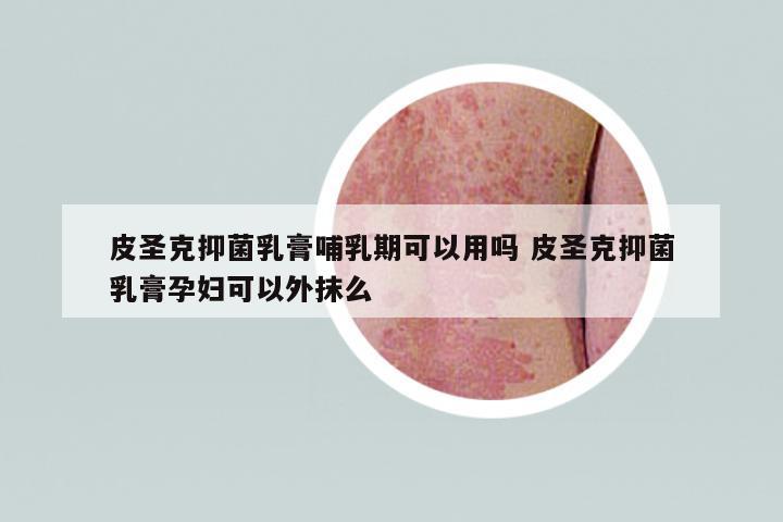 皮圣克抑菌乳膏哺乳期可以用嗎 皮圣克抑菌乳膏孕婦可以外抹么